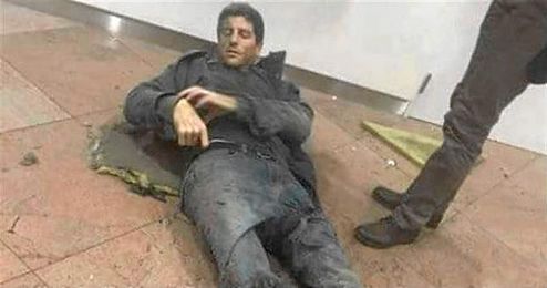 Bellin, herido y sangrando en el suelo del aeropuerto belga. Bellin, herido y sangrando en el suelo del aeropuerto belga.