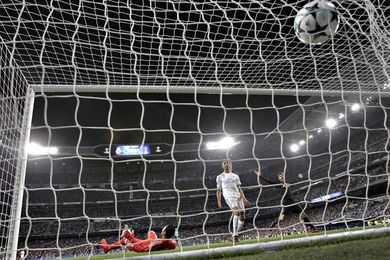 Keylor sufre una lesión muscular tras forzar su regreso Keylor sufre una lesión muscular tras forzar su regreso